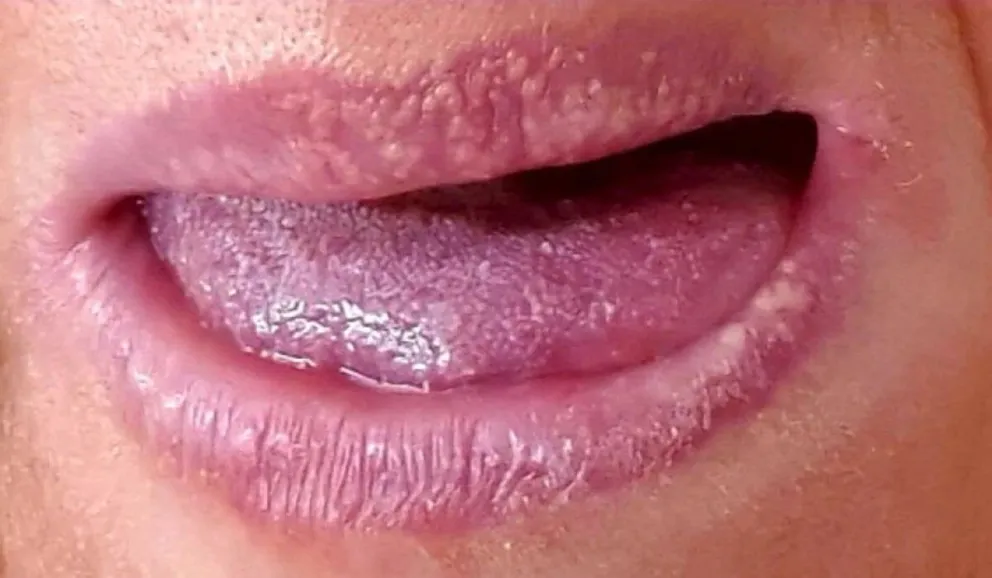 boca
