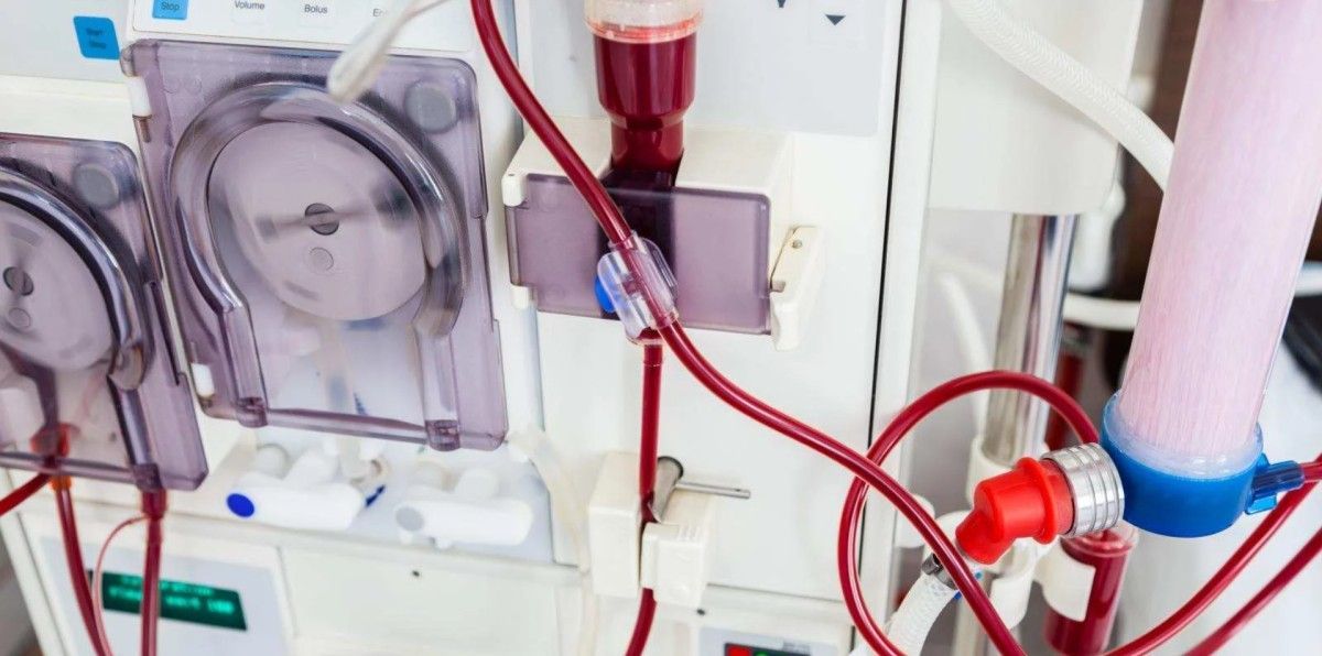 Enfermedad Renal Crónica 