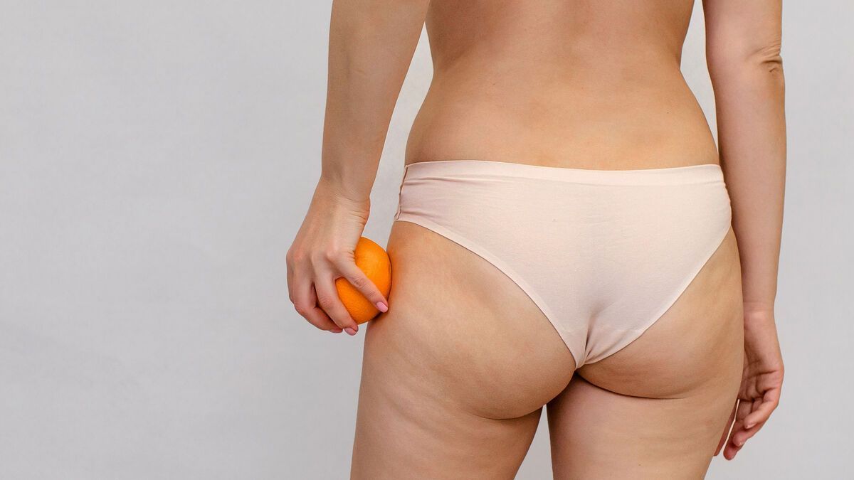 celulitis
