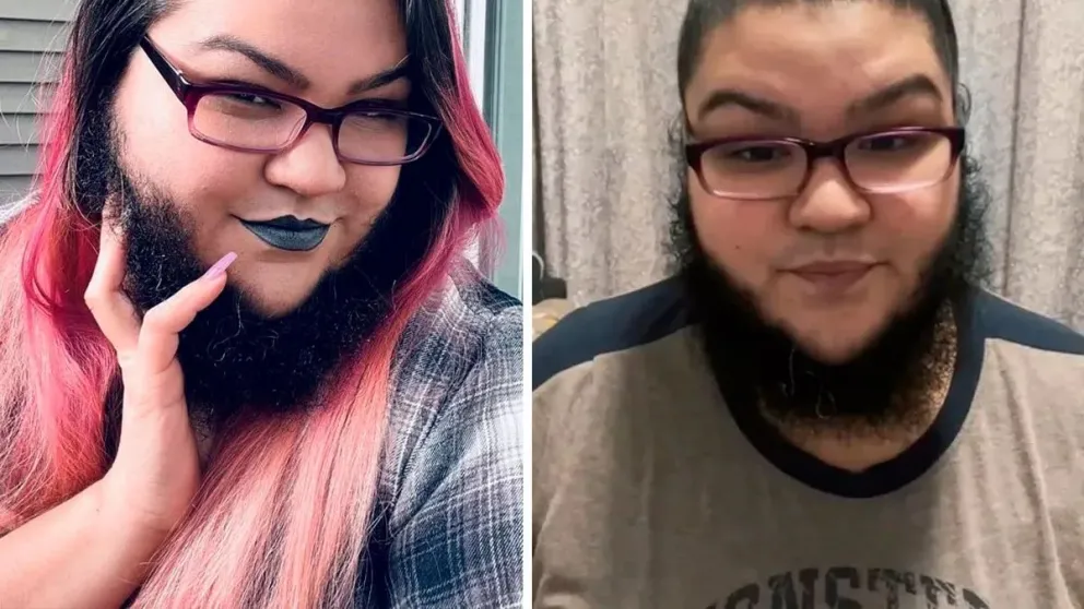 hermosa-barba