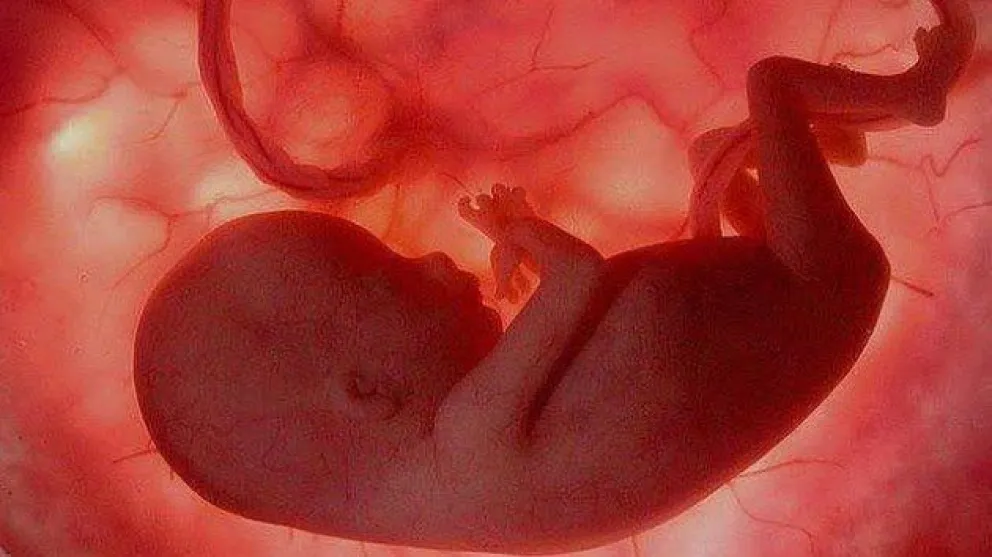aborto
